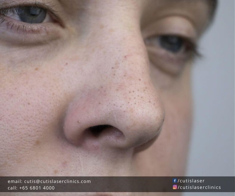 Clean-and-Unclog-Nose-Pores Clean-and-Unclog-Nose-Pores