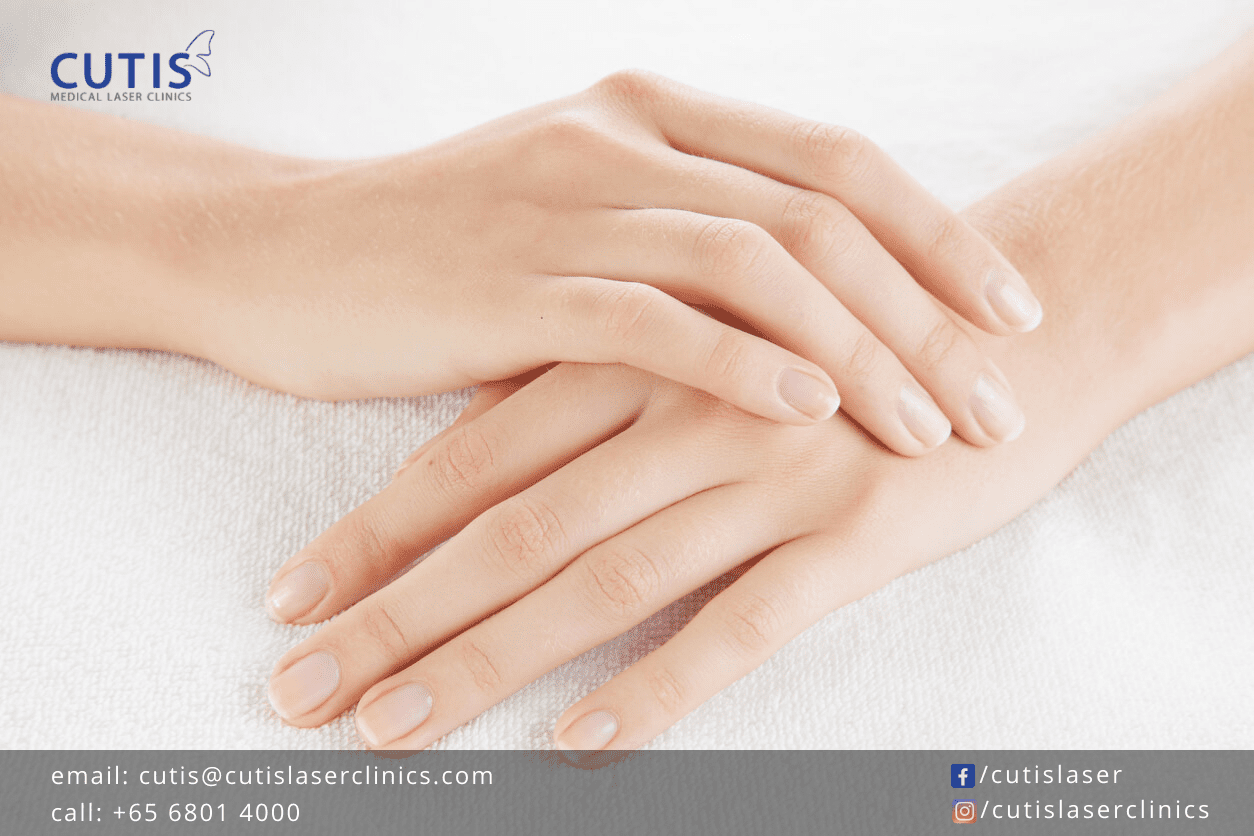 Bothered with Aging Hands? Try Calcium hydroxylapatite