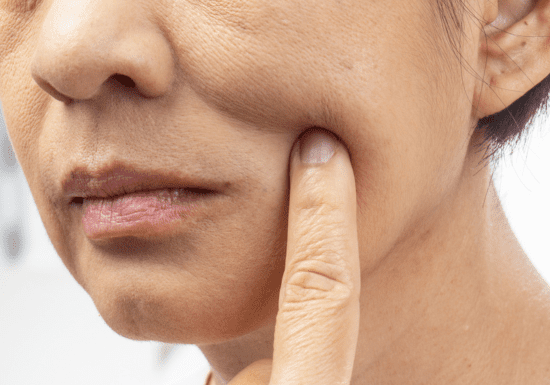 Refreshed face after aging skin treatments