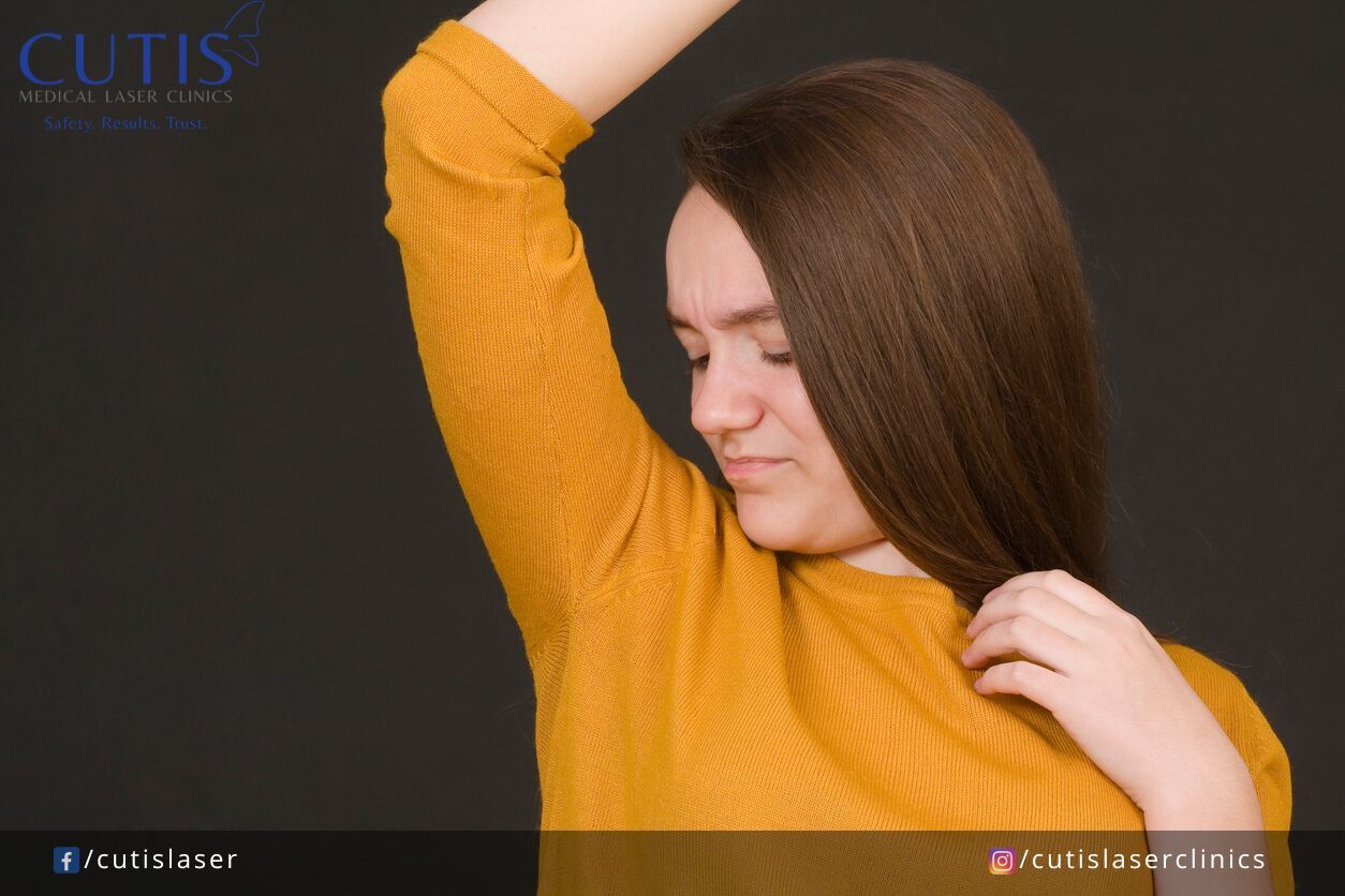 Excessive Sweating? Here’s What You Should Know About Hyperhidrosis