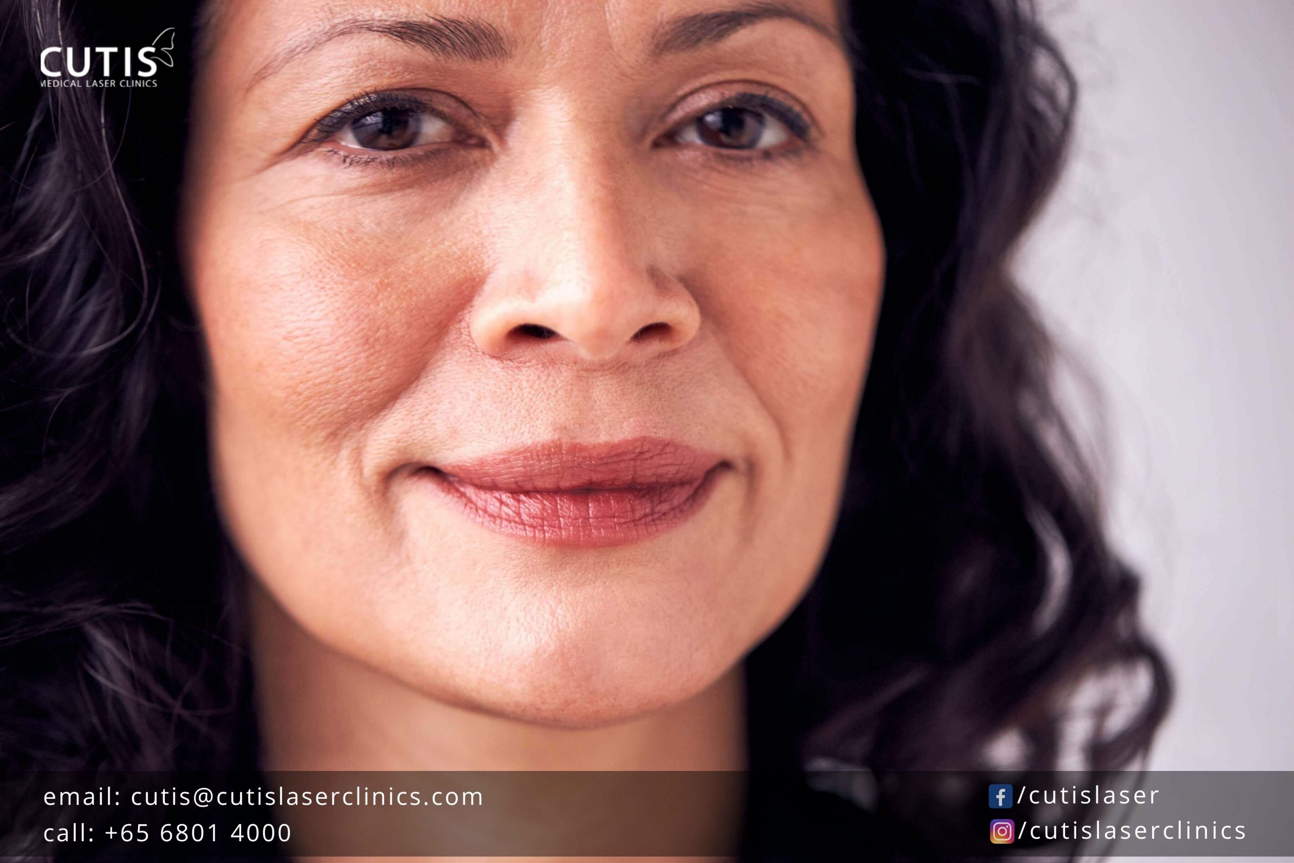 Titan-Skin-Tightening_Cutis Titan-Skin-Tightening_Cutis