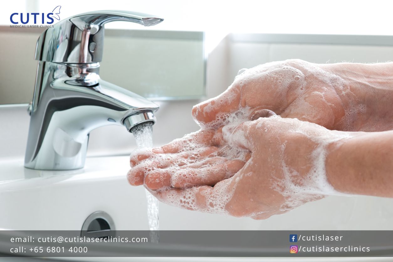 Over-washed Hands How to Care for Them