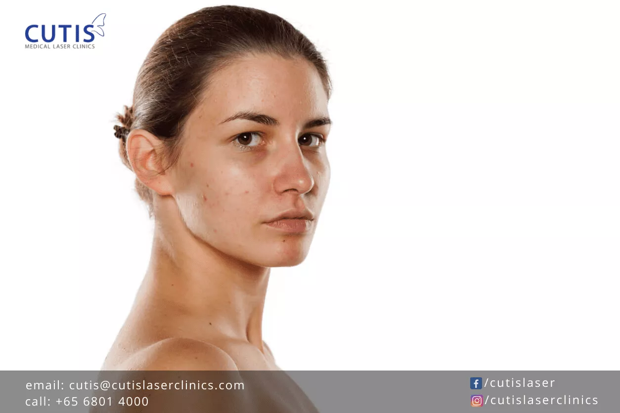 5 Surprising Causes of Pigmentation