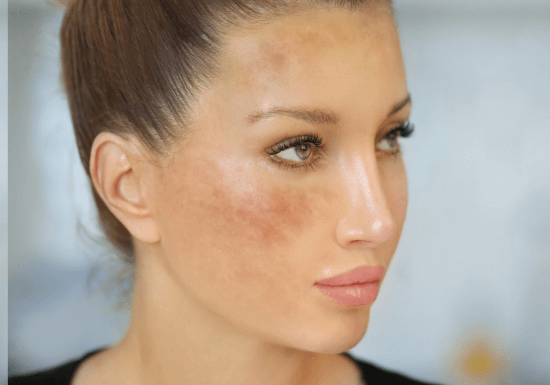 Skin Quality