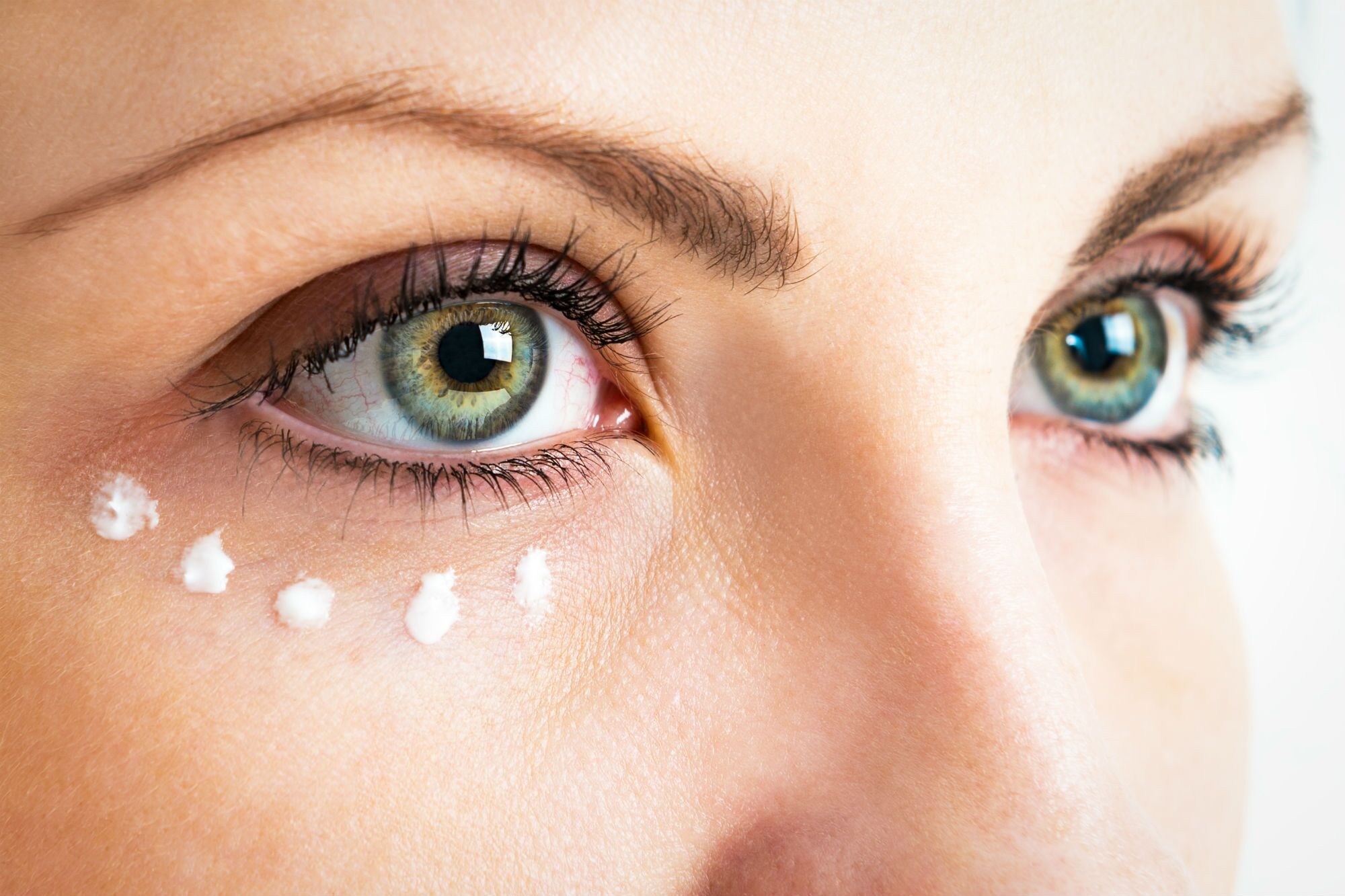 Remove-Dark-Under-Eye-Circles