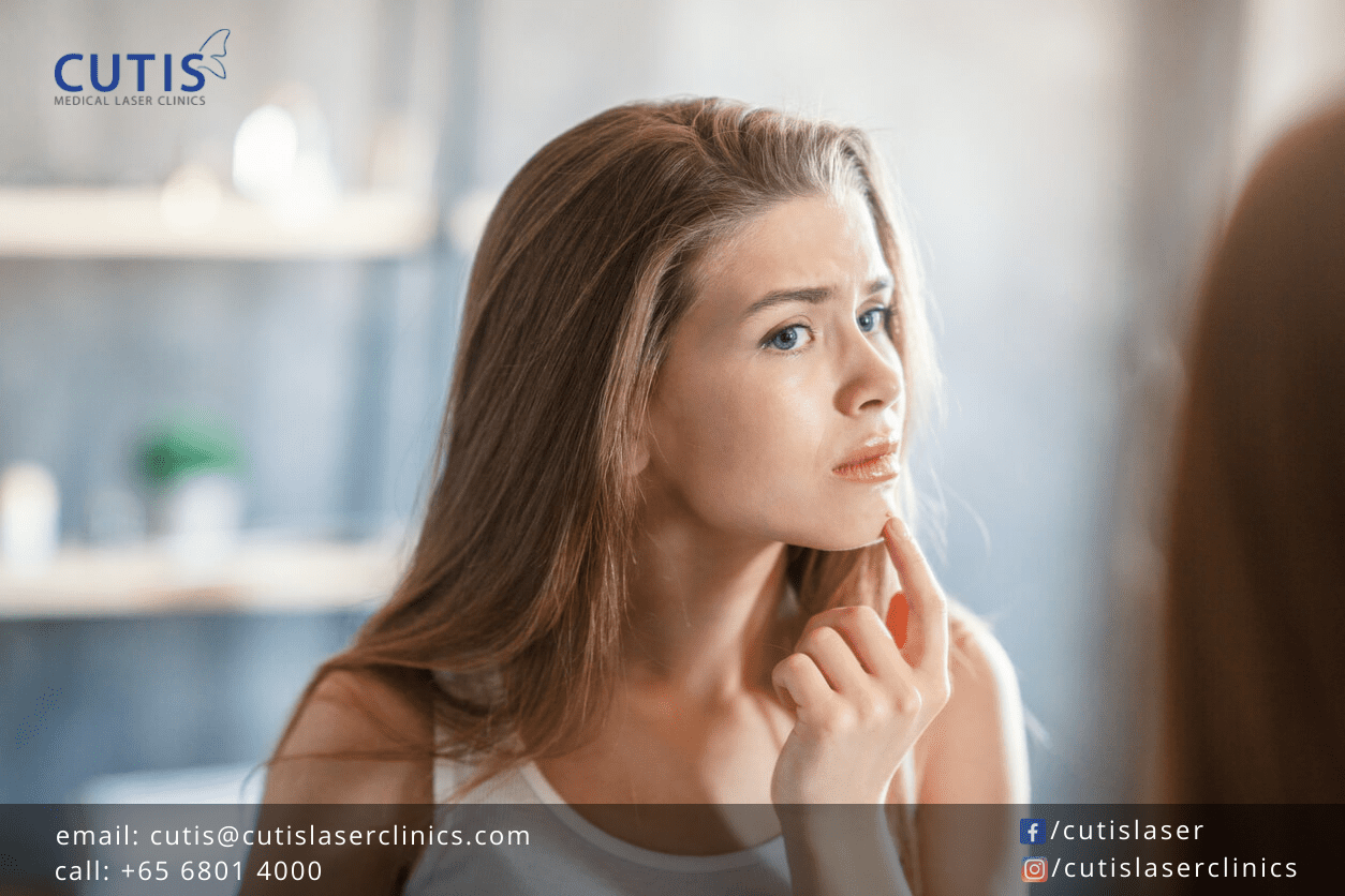 Do You Know Your Skin Type