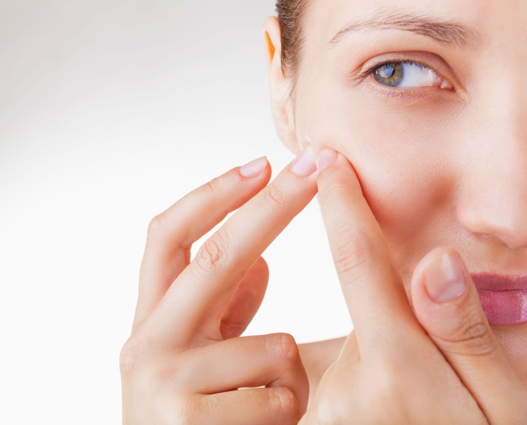 What-Causes-Acne-and-How-to-Cure-It
