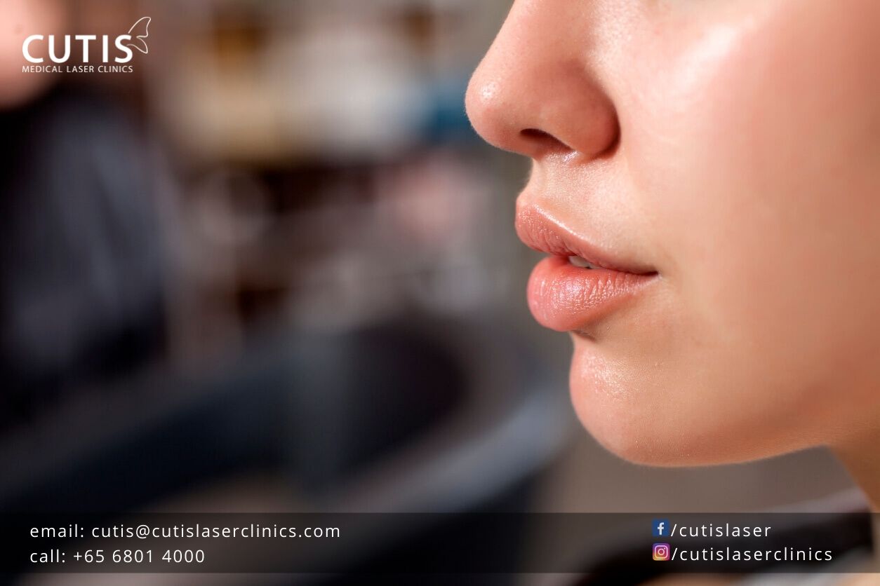Need-to-Anti-Age-Your-Lips-DrSylvia-SkinCare Need-to-Anti-Age-Your-Lips-DrSylvia-SkinCare
