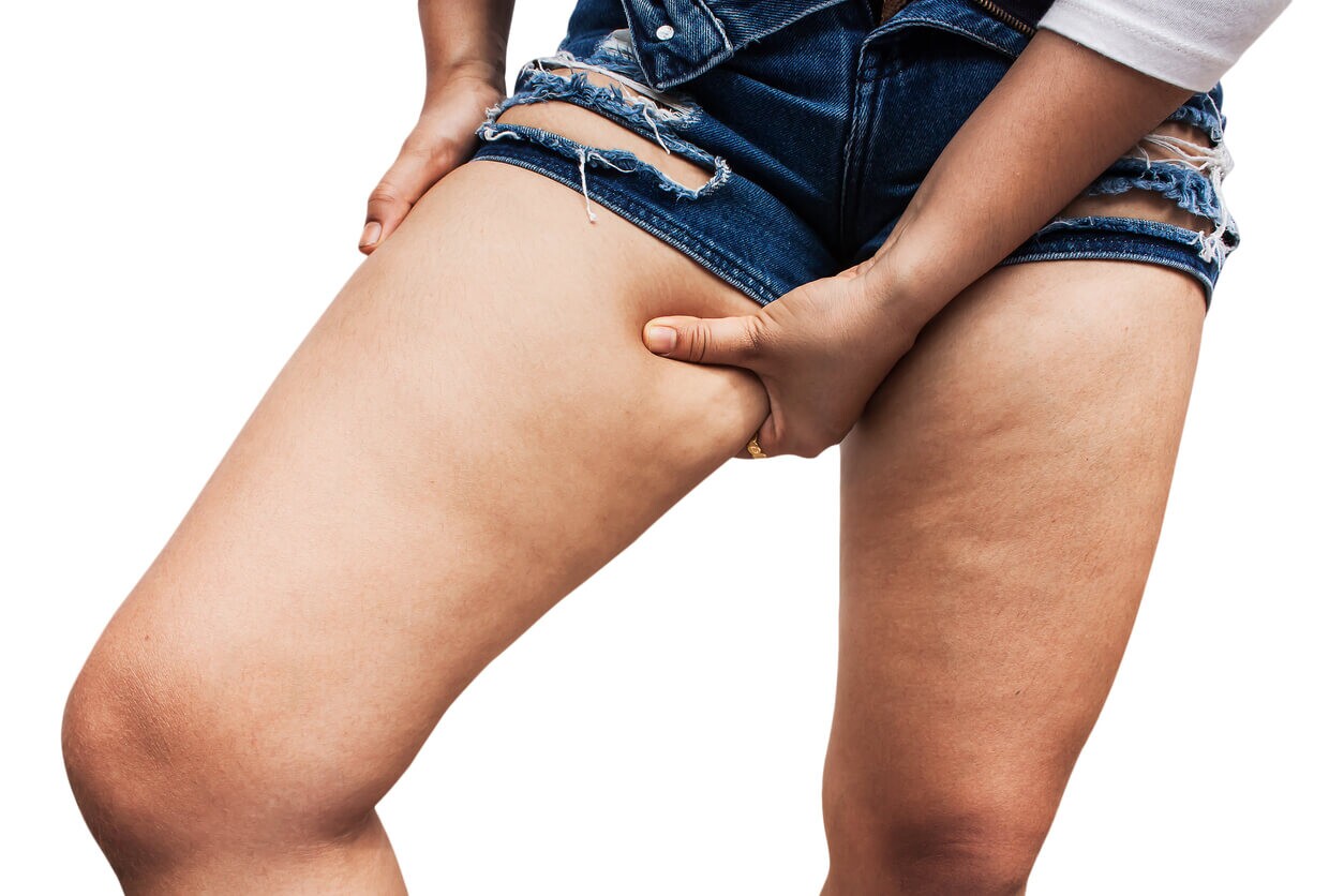 Reducing-Cellulite-Appearance Reducing-Cellulite-Appearance