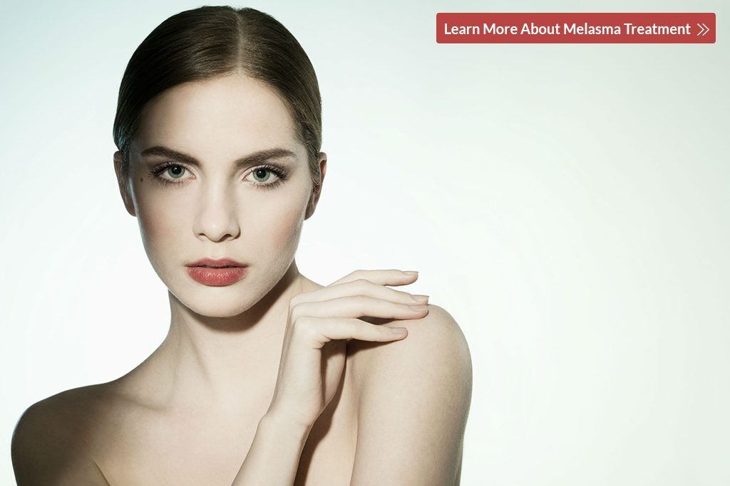 Melasma-Treatment