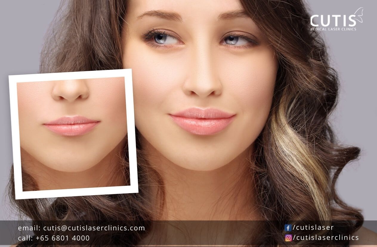 Caring-for-Your-Lips-After-Dermal-Fillers Caring-for-Your-Lips-After-Dermal-Fillers