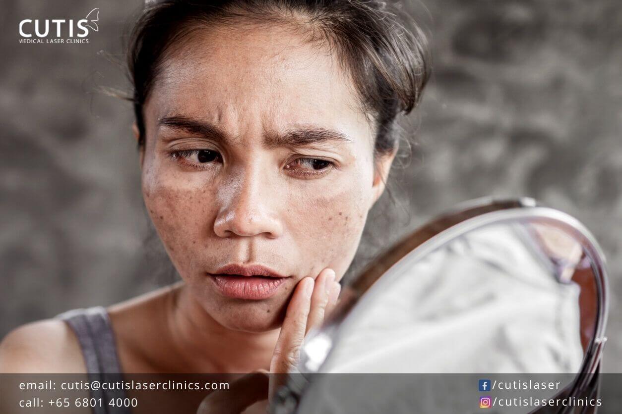 Is-Your-Skin-Crying-for-Help Is-Your-Skin-Crying-for-Help
