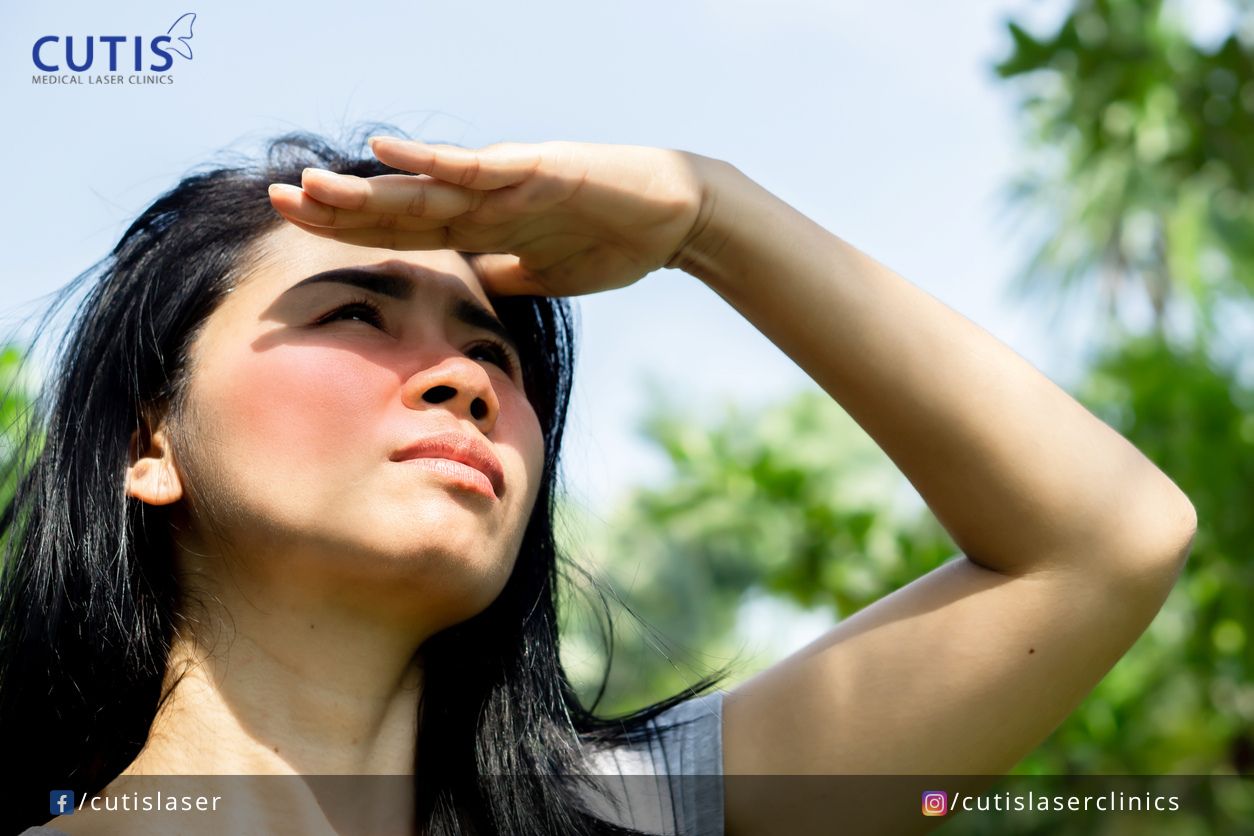 What Age Does Sun Damage Start to Show