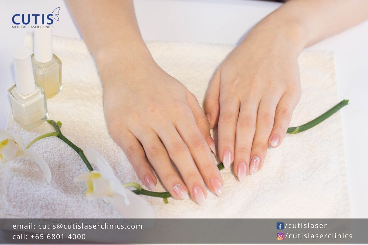 4-Ways-to-Treat-Age-Spots-on-Your-Hands 4-Ways-to-Treat-Age-Spots-on-Your-Hands