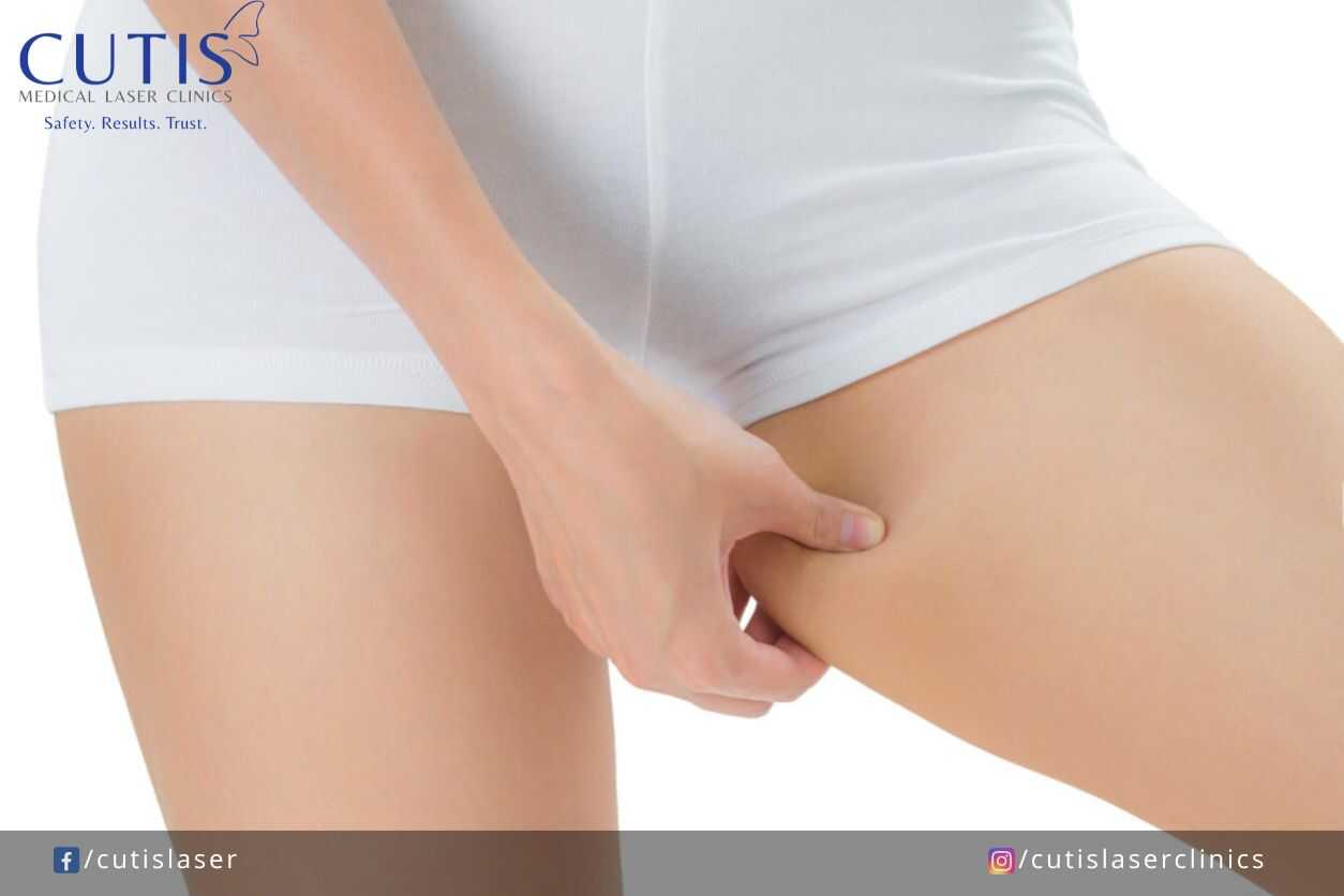 Debunking 7 Myths About Dark Inner Thighs
