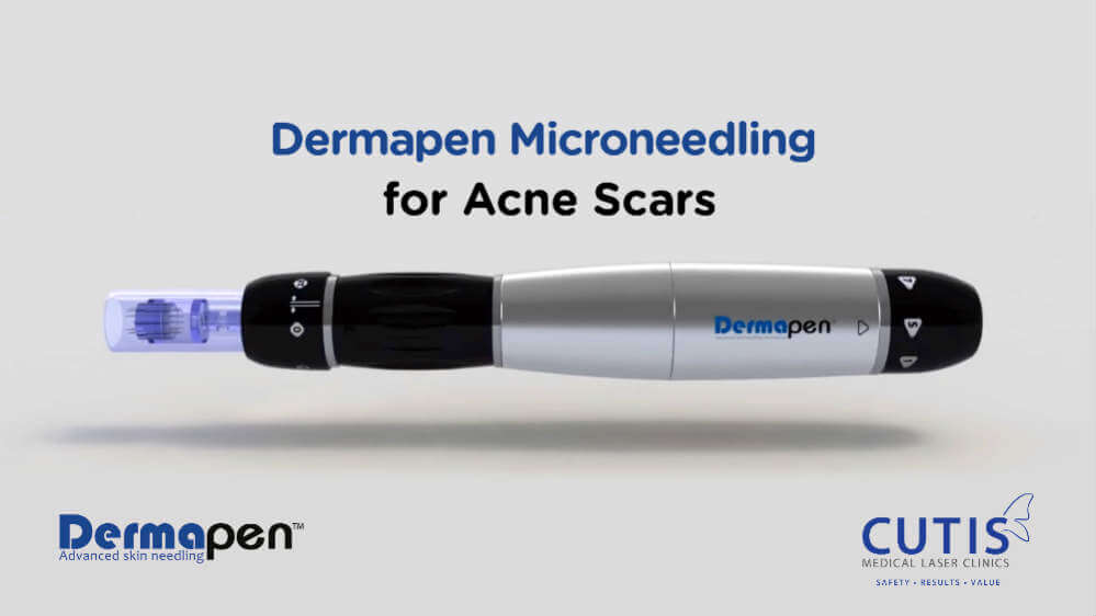 Dermapen-Microneedling