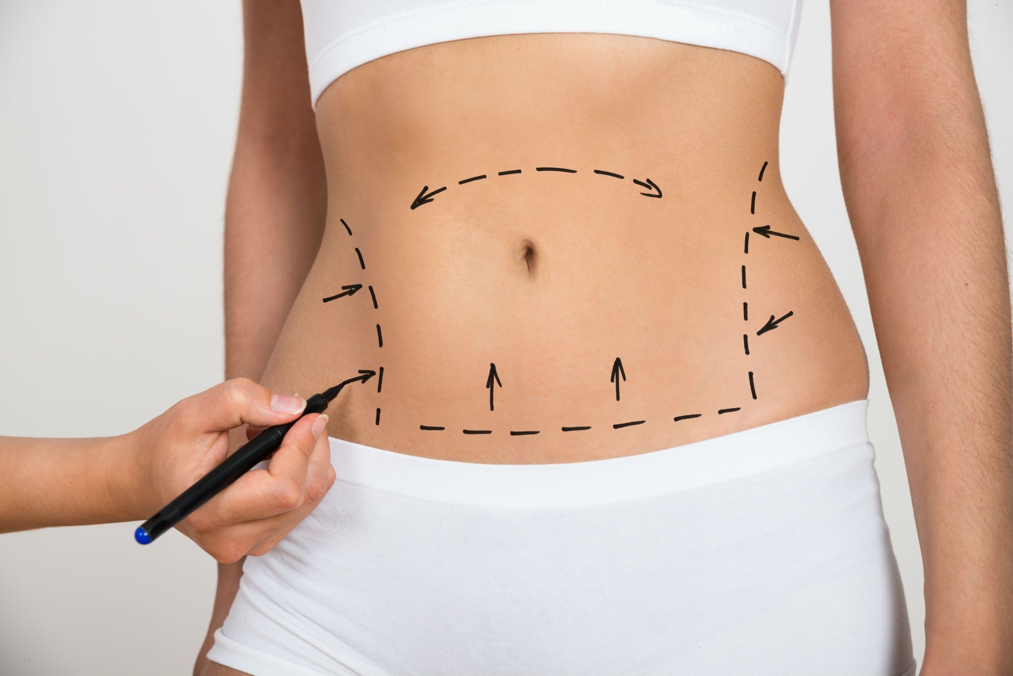 5 Ways for Skin Tightening in Singapore Toning Loose Belly