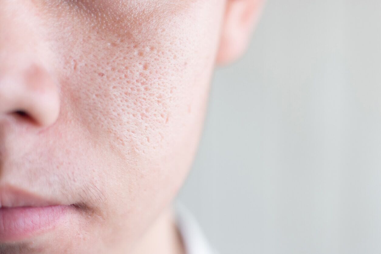 Do-Your-Pores-Look-Big