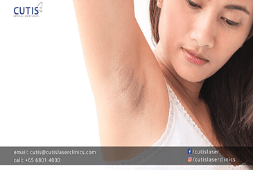 Do You Have Dark Underarms?