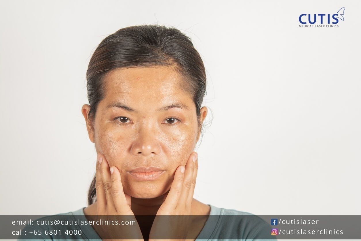 How-Hormones-Affect-Your-Skin