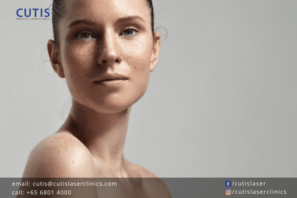 VI Peel Precision Plus The Chemical Peel for Your Pigmentation Concerns