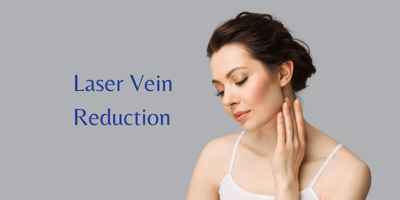 Laser Vein Reduction