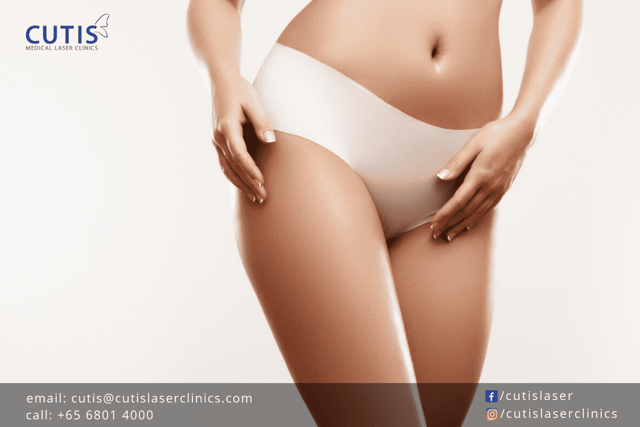Do You Have Dark Underwear Lines or Bikini Area? 