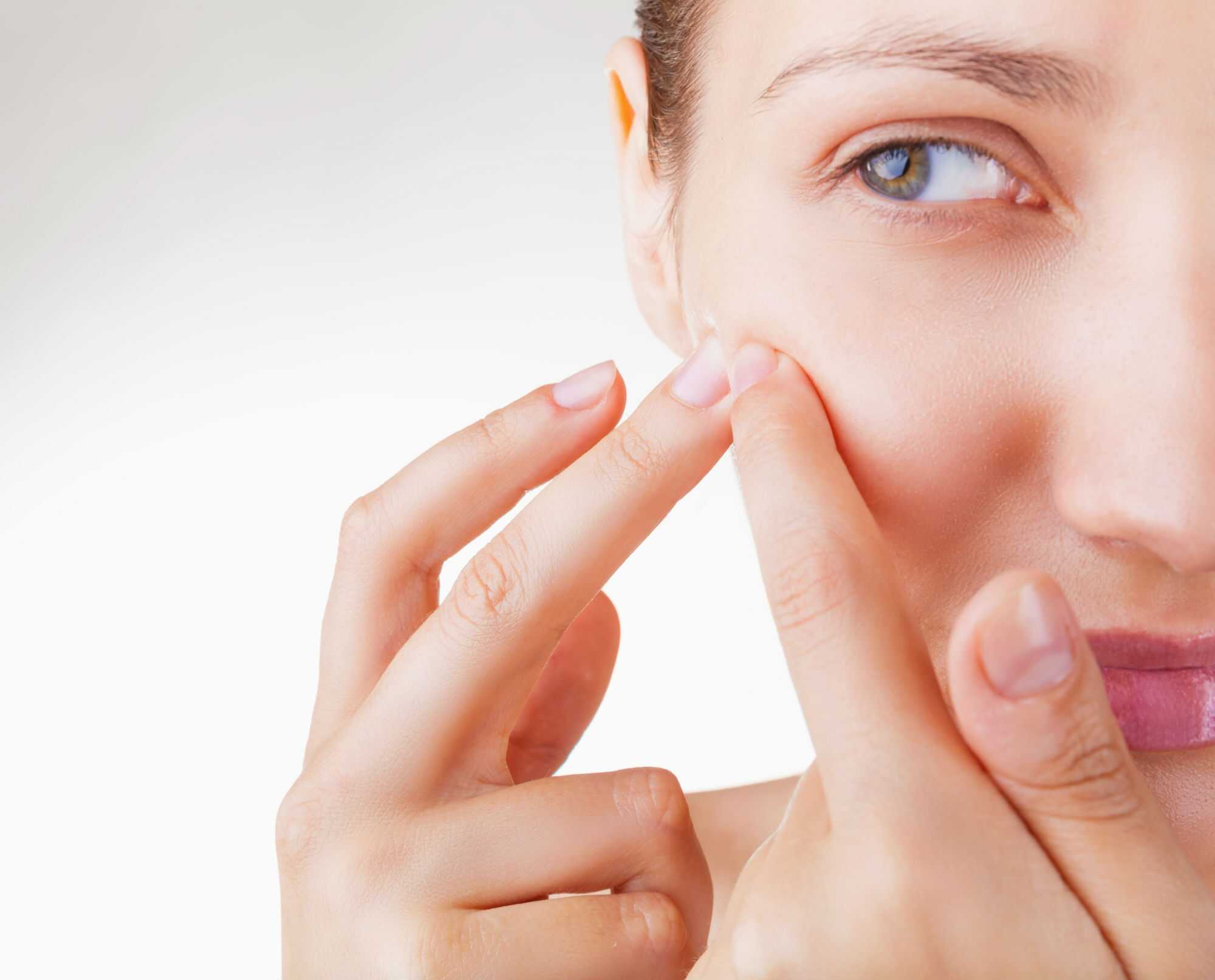 What-Causes-Acne-and-How-to-Cure-It