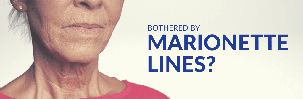 Marionette_Lines