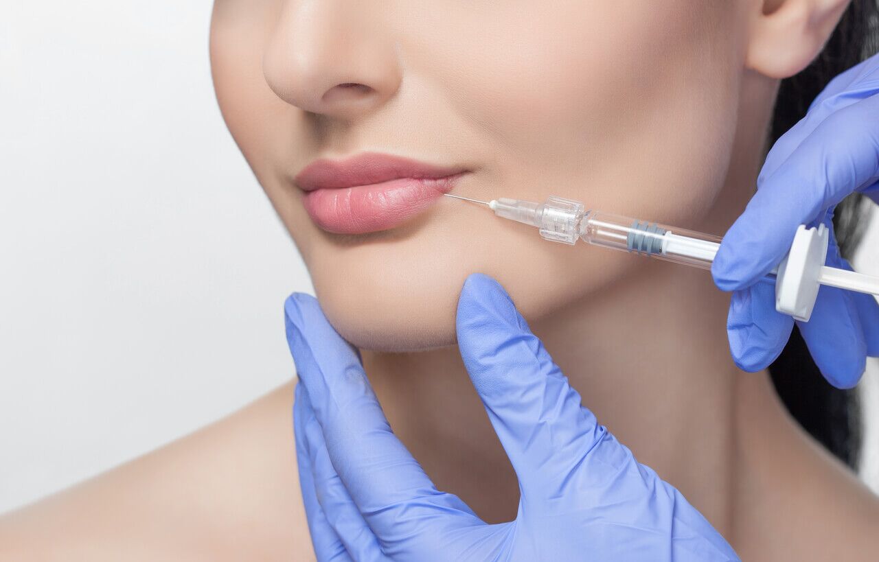 5 Things to Look Out For When Doing Fillers