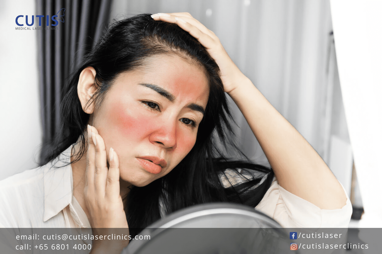 Facial Redness Causes and Tips to Reduce Redness on the Face
