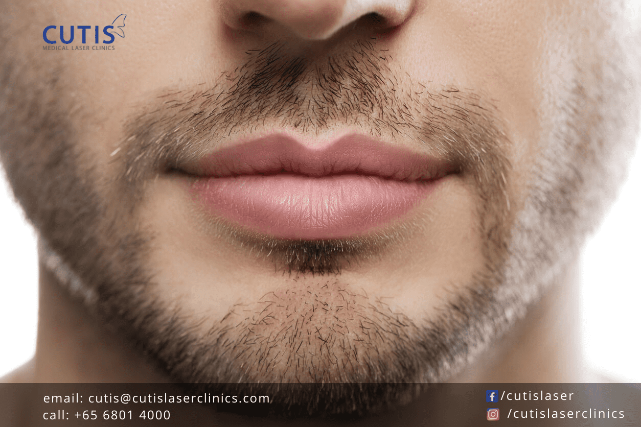 Lip Fillers for Men Things You Should Know