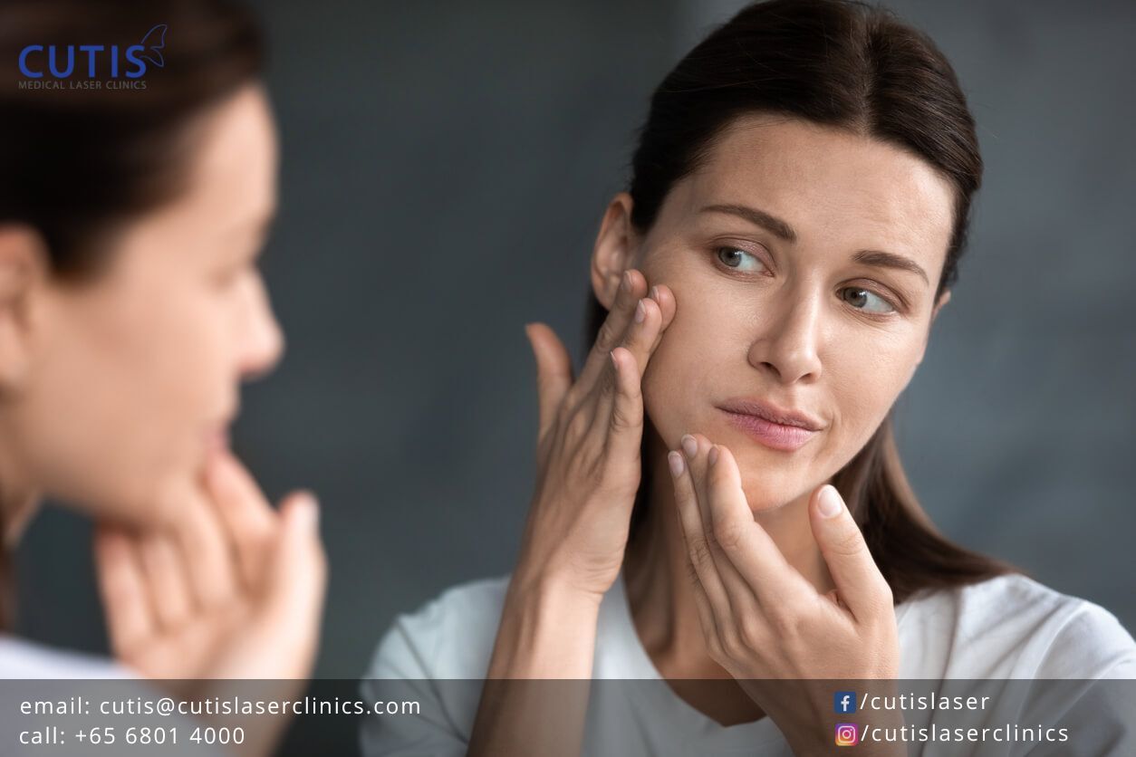 Surprise or Sudden Breakouts: Causes and Treatment Options