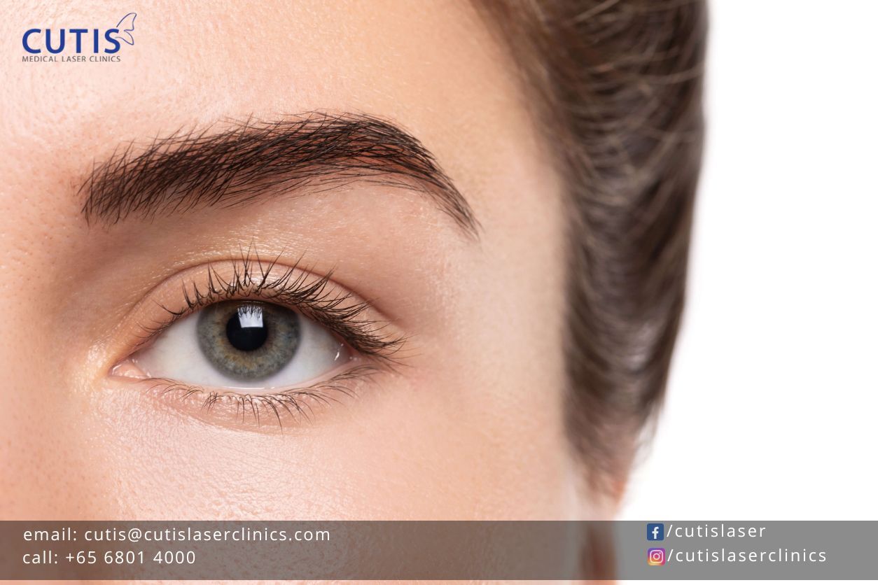 5 Non-Surgical Alternatives to Blepharoplasty or Eyelid Surgery