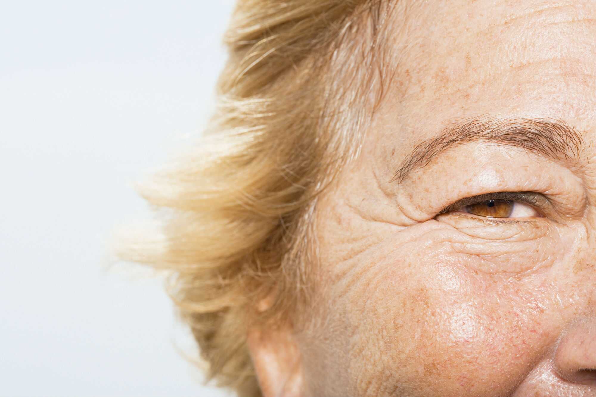 Wrinkles