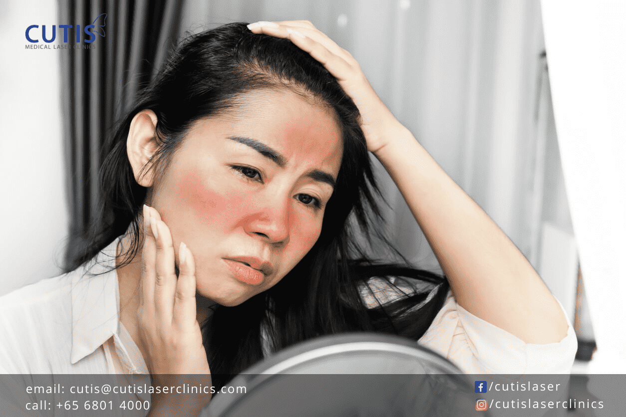 Facial Redness Causes and Tips to Reduce Redness on the Face